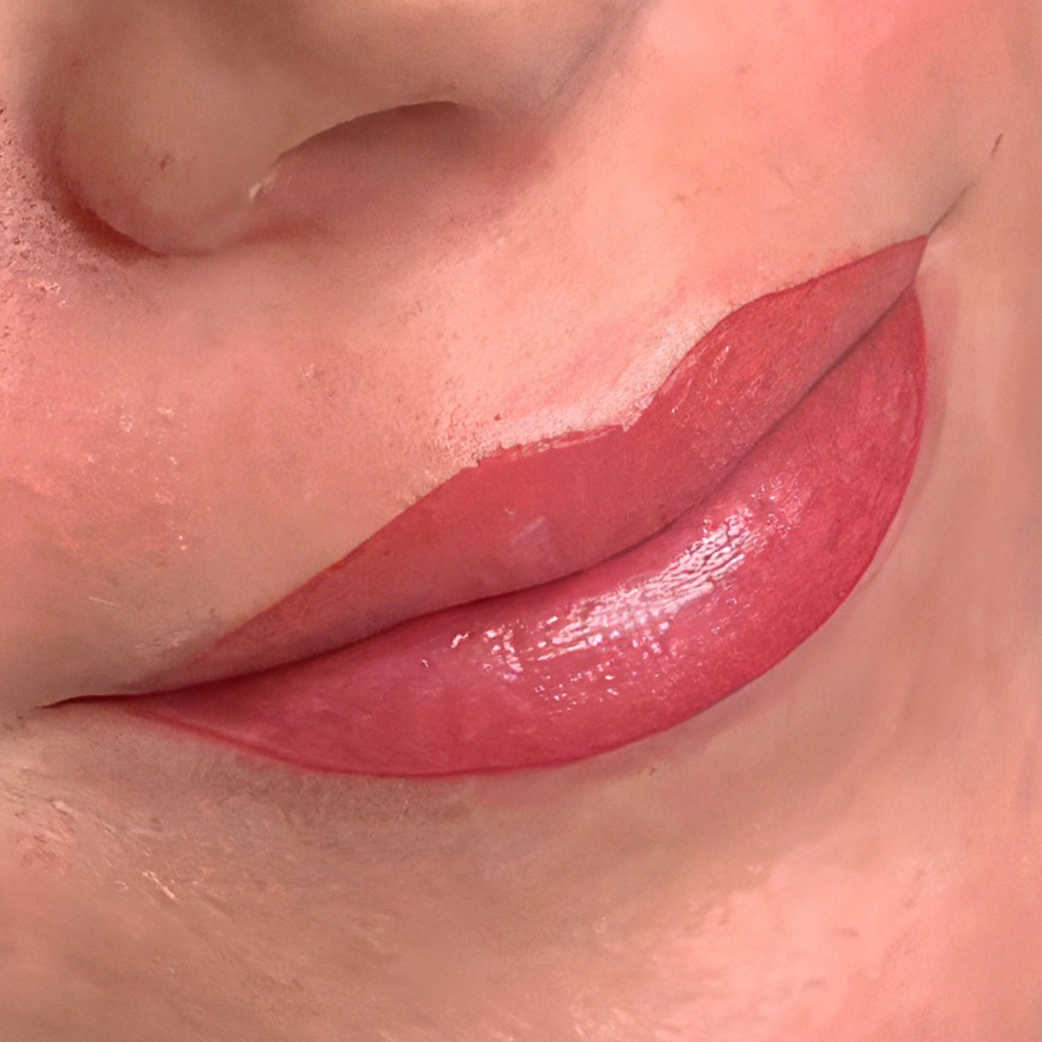 Pigmentierte Lippen