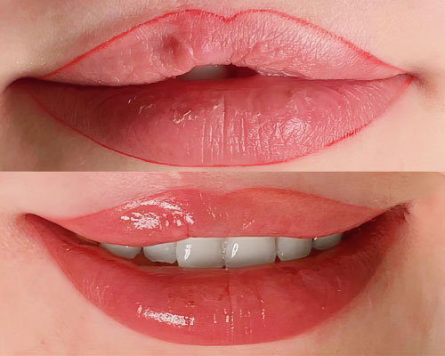 Medizinische Pigmentierung der Bellmann Masterclass Lips